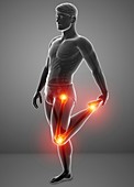 Man with knee pain, illustration