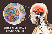 Encephalitis caused by West Nile virus, illustration