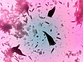 Plankton under IBM autonomous microscope
