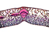 Bearberry leaf, light micrograph