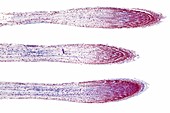 Hyacinth root, light micrograph