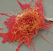 Liver cancer cell, SEM