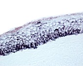 Melanin in thin skin epidermis, light micrograph