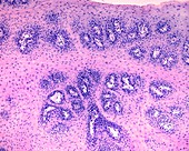 Soft palate papilloma, light micrograph