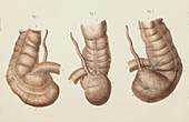 Caecum anatomy, 1866 illustration