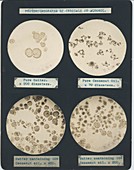 Micrographs of fatty food crystals, 1907