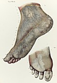 Foot lymphatic vessels, 1866 illustration