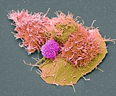 Natural killer cell and cancer cell, SEM