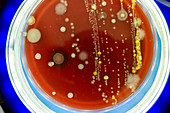 Petri dish with colonies of microbes