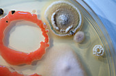 Microbes growing on agar