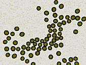 Hepatitis C virus particles, illustration