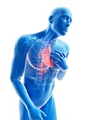 Illustration of a man with chest pain