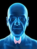 Illustration of an old man's thyroid gland