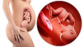 Illustration of a pregnant woman and 37 week foetus