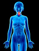 Illustration of larynx cancer