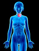 Illustration of thyroid gland cancer