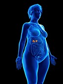 Illustration of an obese woman's adrenal glands