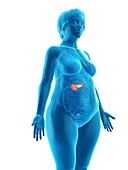 Illustration of an obese woman's pancreas