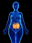 Illustration of an obese woman's small intestine