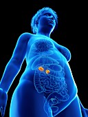 Illustration of an obese woman's adrenal glands