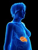 Illustration of an obese woman's spleen