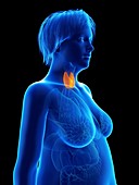 Illustration of an obese woman's thyroid gland