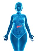 Illustration of an obese woman's pancreas