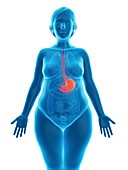 Illustration of an obese woman's stomach