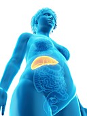 Illustration of an obese woman's liver