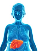 Illustration of an obese woman's liver