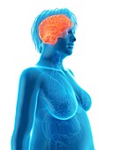 Illustration of an obese woman's brain