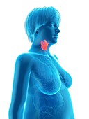 Illustration of an obese woman's larynx