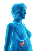 Illustration of an obese woman's pancreas