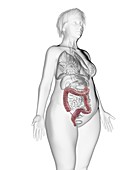 Illustration of an obese woman's colon