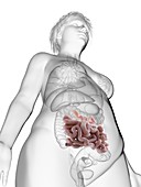 Illustration of an obese woman's small intestine