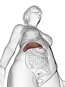 Illustration of an obese woman's liver