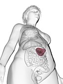 Illustration of an obese woman's spleen