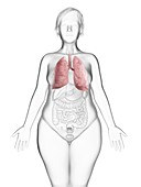 Illustration of an obese woman's lung