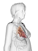 Illustration of an obese woman's heart