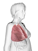 Illustration of an obese woman's lung