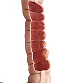 Illustration of the human colon