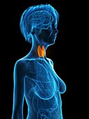 Illustration of an old woman's thyroid gland