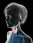 Illustration of an old woman's thyroid