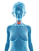 Illustration of an old woman's thyroid gland