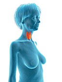 Illustration of an old woman's thyroid gland