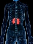 Illustration of inflamed kidneys