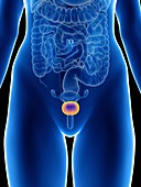 Illustration of a woman's bladder