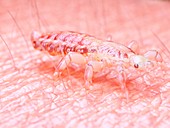Illustration of a head louse on human skin