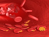 Illustration of malaria infected blood cells