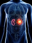 Illustration of a man's kidneys cancer